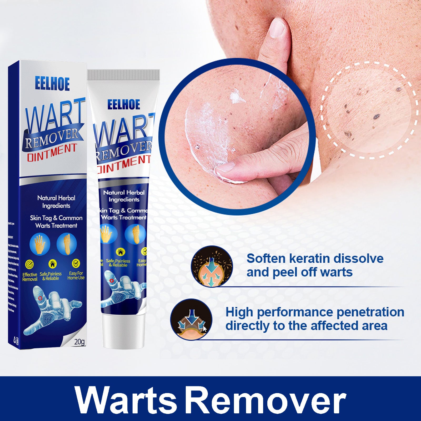 Advanced Tag & Wart Removal Cream – Fast-Acting Smoothing & Skin Clearing Formula