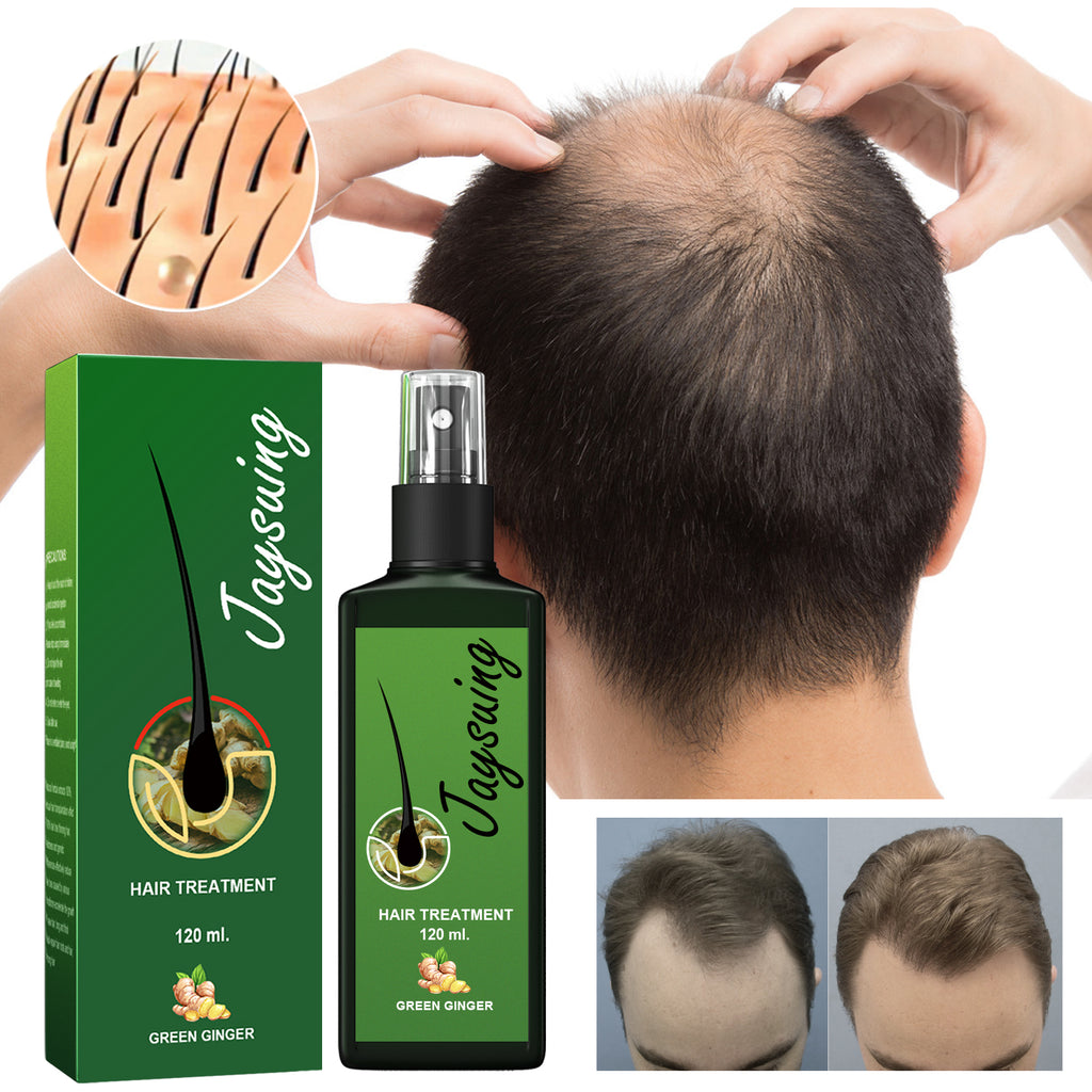 Ginger Intensive Hair Growth Spray – Root Repair & Anti-Hair Loss Serum