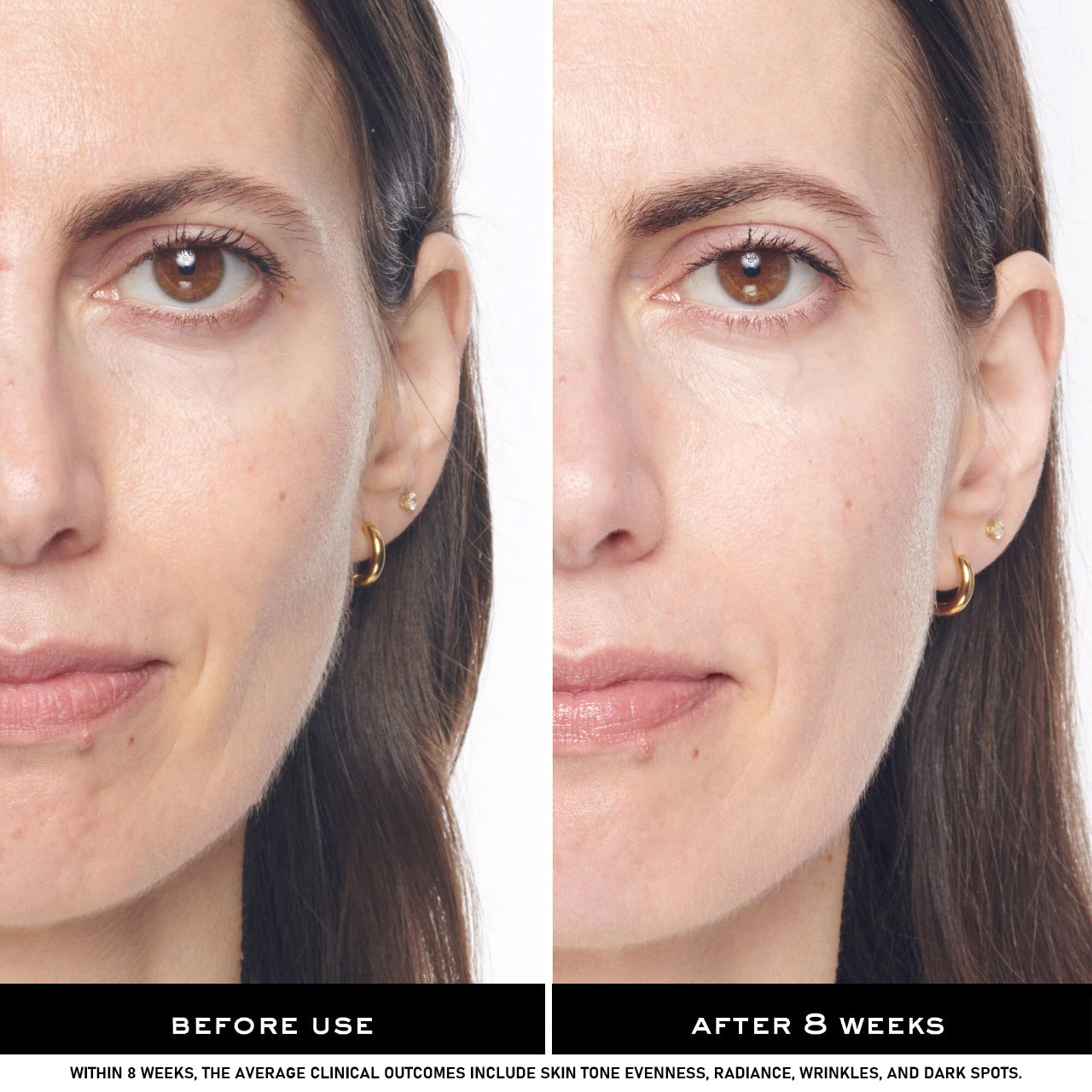 V-Line Face Sculpting Cream – Intensive Lifting & Double Chin Reduction Formula